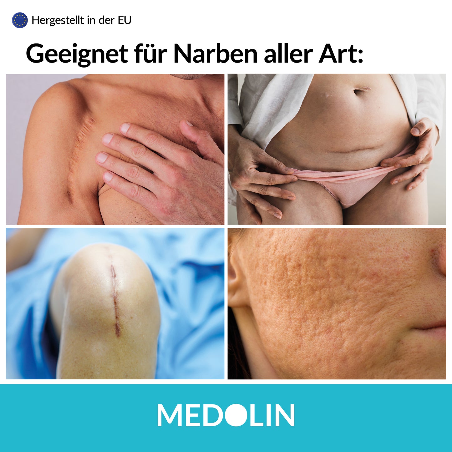 Medolin Narben Gel