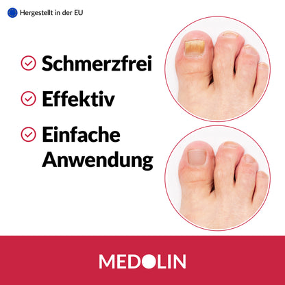 Medolin Nagelpilz Lösung