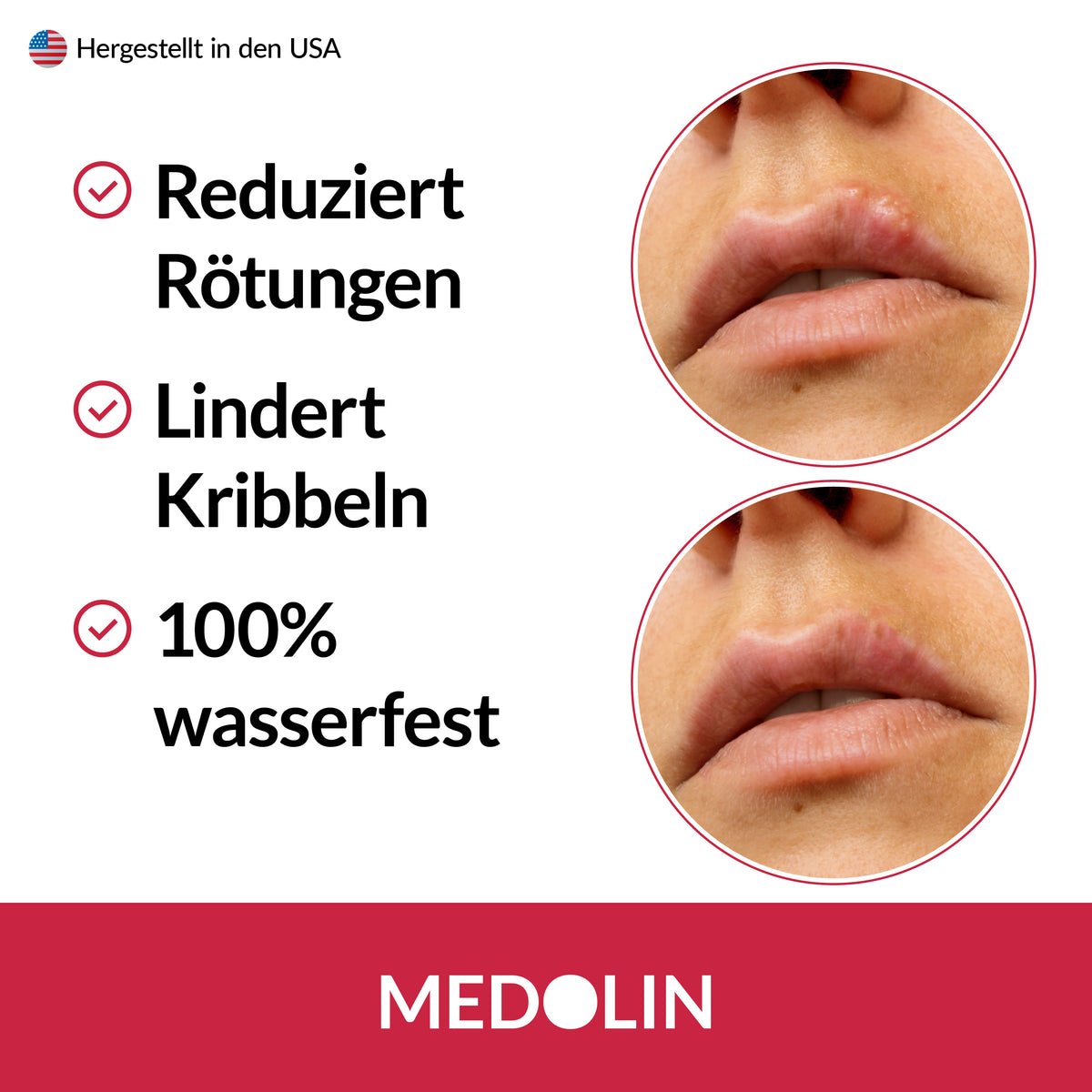 3x Medolin Lippenherpes Pflaster