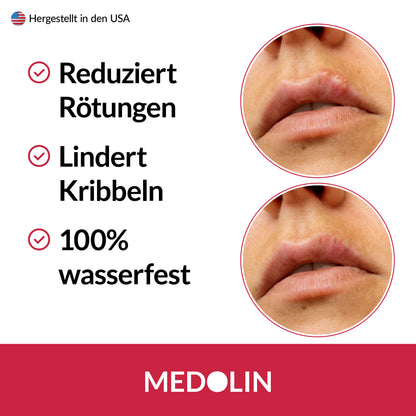 3x Medolin Lippenherpes Pflaster