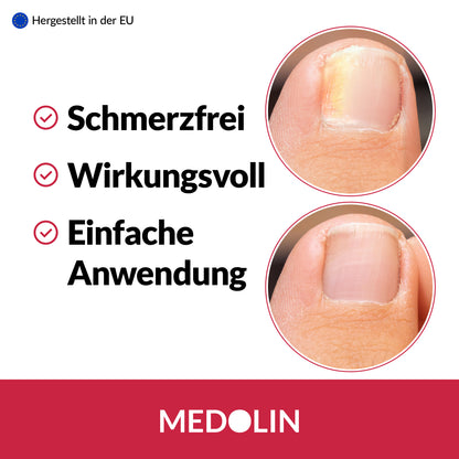 Medolin Nagelpilz Lösung