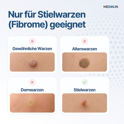 Medolin Stielwarzen Weg